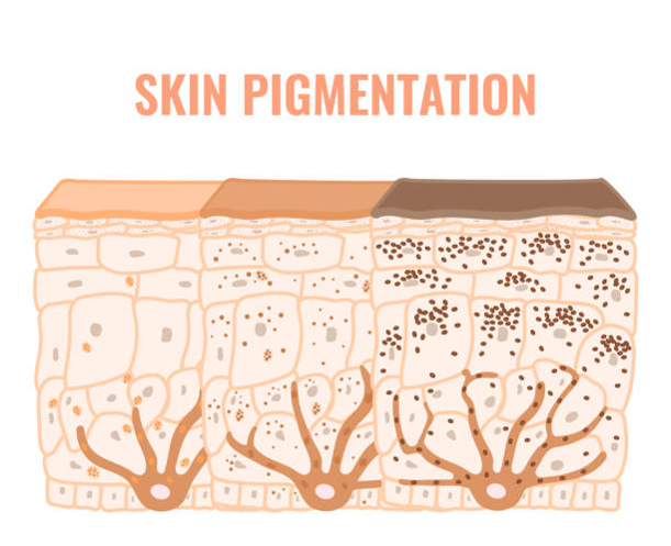 Pigmented Treatments croped pigmentation