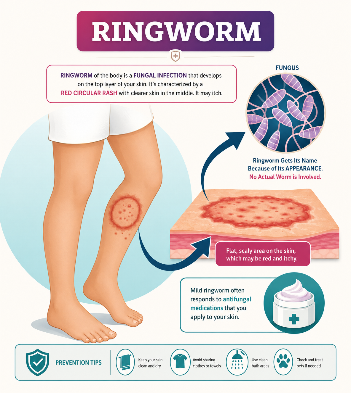 Skin Disease Management fungal infection final fiagram